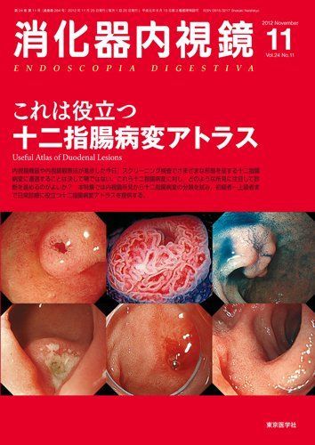 消化器内視鏡 第24巻11号 0 これは役立つ十二指腸病変アトラス