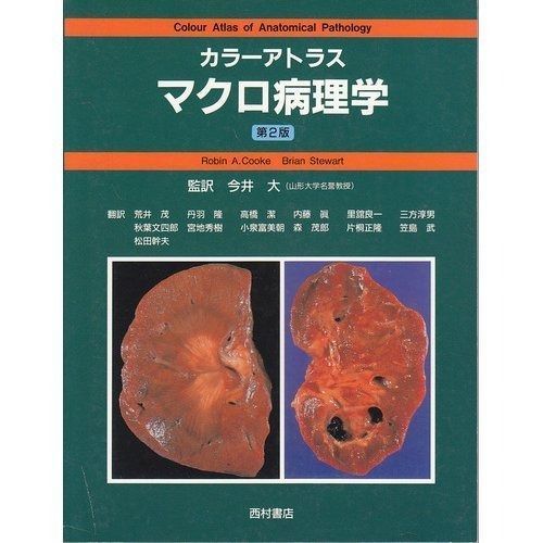 マクロ神経病理学アトラス マクロ神経病理学アトラス_立ち読み