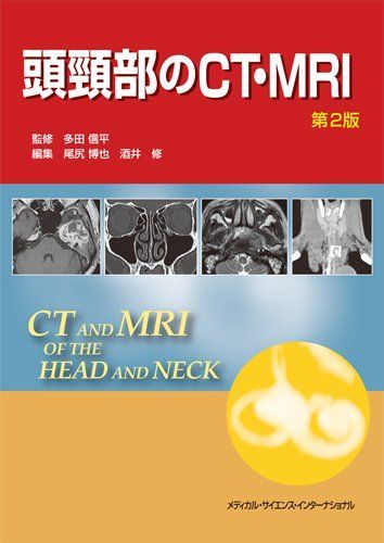 頭頸部のCT・MRI 第2版 多田信平、 尾尻博也; 酒井 修 頭頸部のCT・MRI 第2版 多田信平、 尾尻博也; 酒井 修 - メルカリ