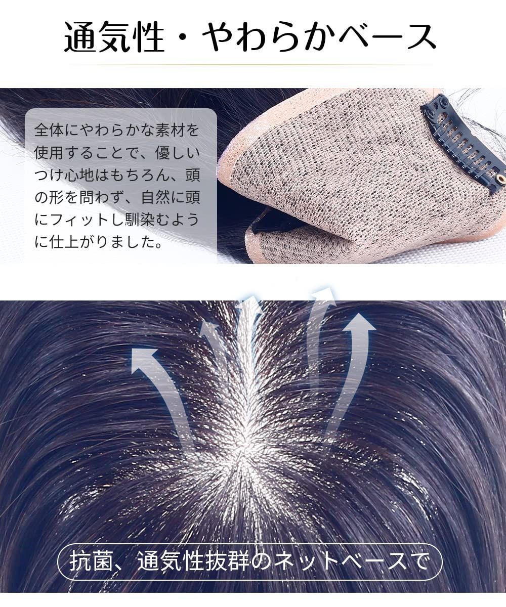 つむじ 頭頂部