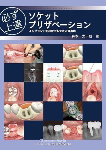裁断済み】【最新版】必ず上達 抜歯手技 増補新版 (必ず上達シリーズ