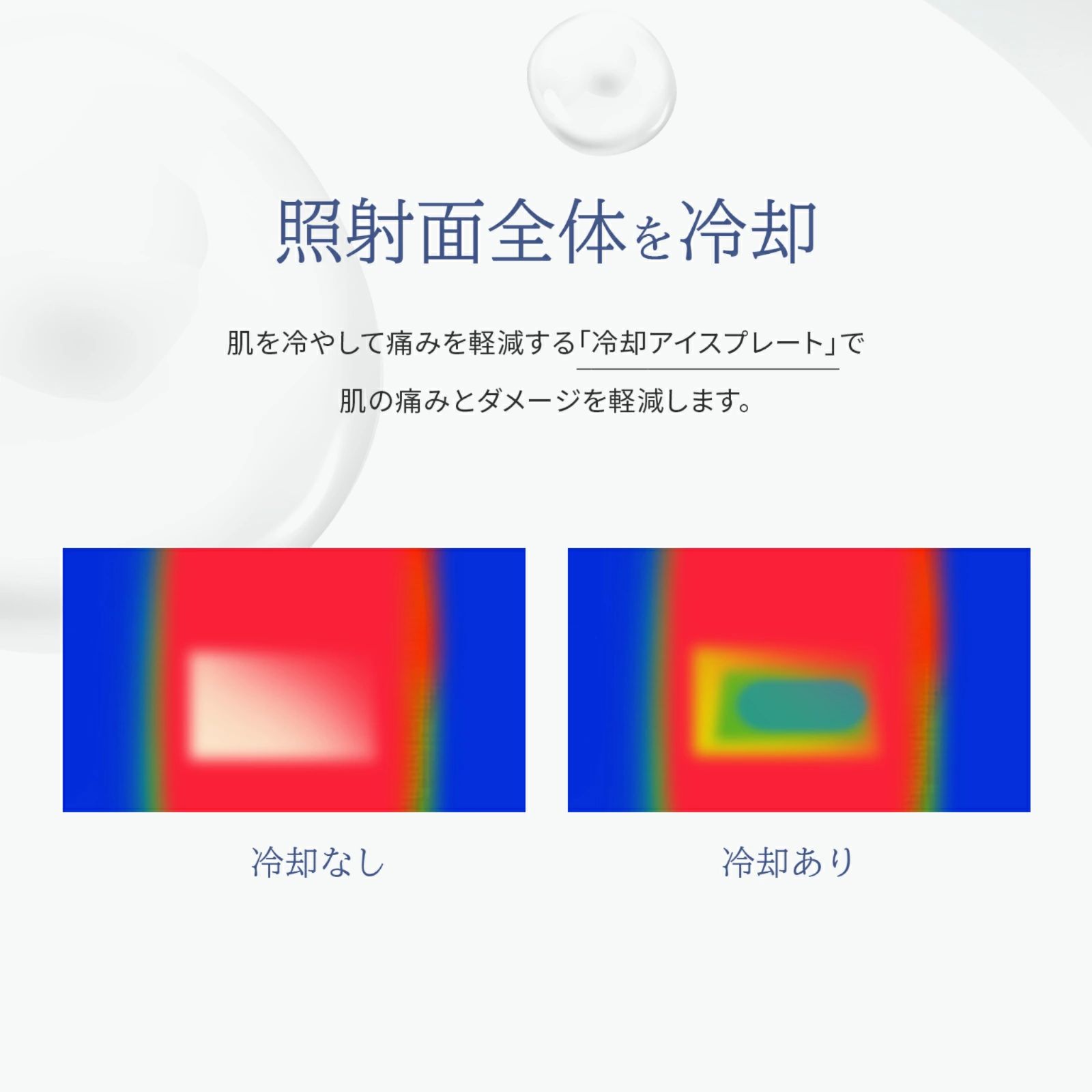 Ejewel 脱毛器 家庭用脱毛器 脱毛機 男女兼用 ipl 光脱毛器 ipl光美容