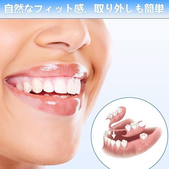 在庫処分】1本 カスタム 入れ歯 部分 取り外し可能 Dentellea 義歯