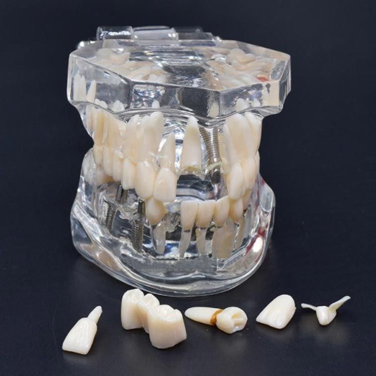 上顎/下顎のモデル 歯 模型 歯形模型 歯列 模型 歯形 模型 透明 研究