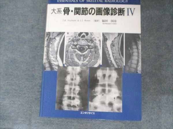 エンタプライズ 大系 骨 関節の画像診断IV 2001 T.R Yochim-L.J.Rowe 022M3D