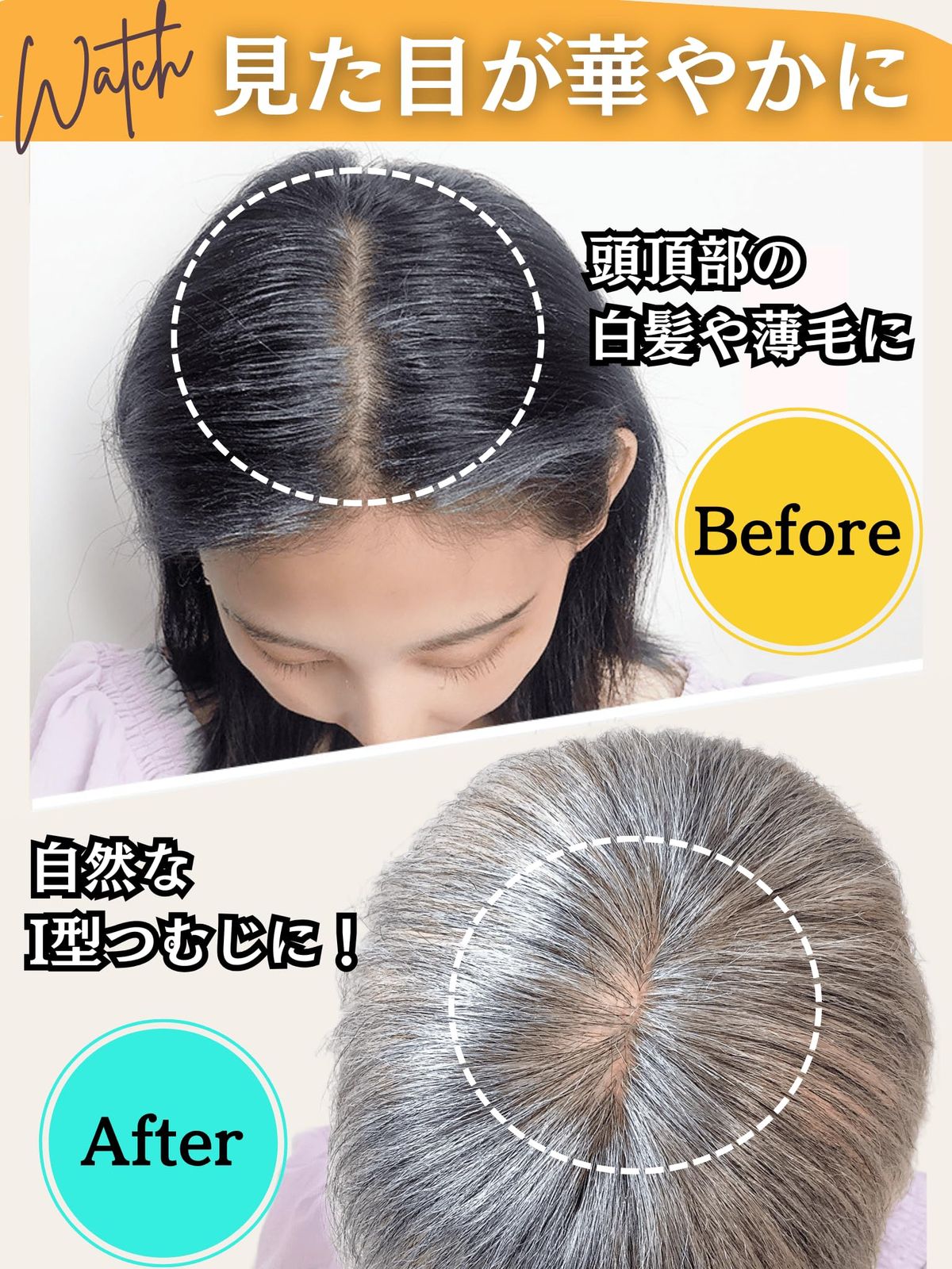 医療用