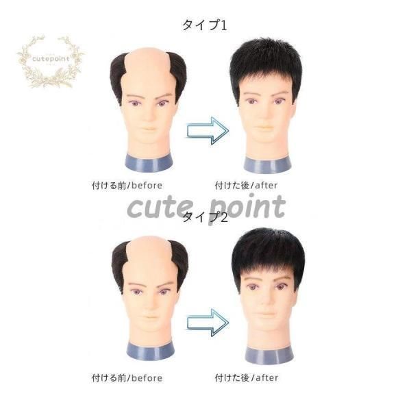 ショート