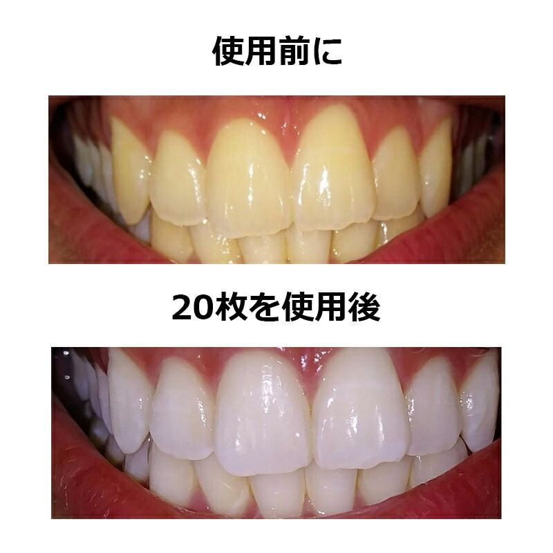 ☆正規品保証☆ Crest 3D White Whitening クレスト ホワイトニング シート テープ 歯磨き粉 20セット/40枚 - メルカリ