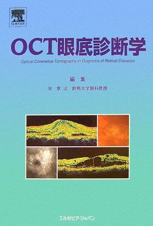 OCT眼底診断学 章治， 岸 - メルカリ