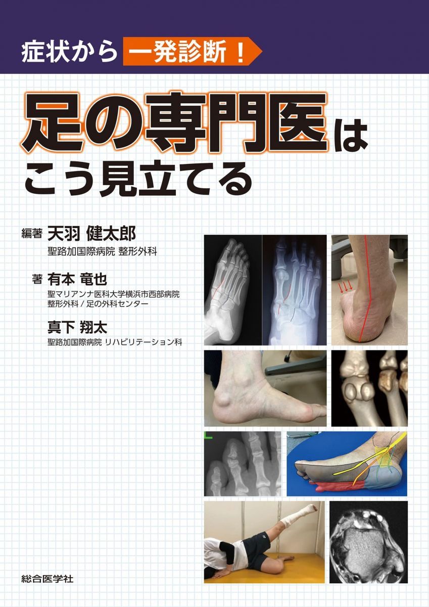 症状から一発診断! 足の専門医はこう見立てる