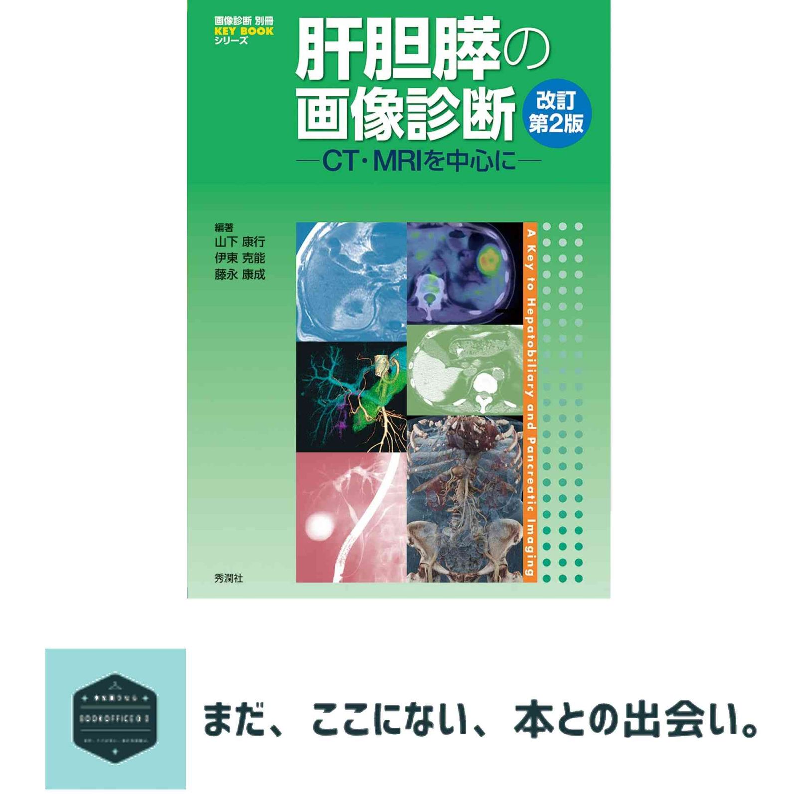 肝胆膵の画像診断  改訂第2版 肝胆膵の画像診断 改訂第2版: CT・MRIを中心に (画像診断別冊) | 山下