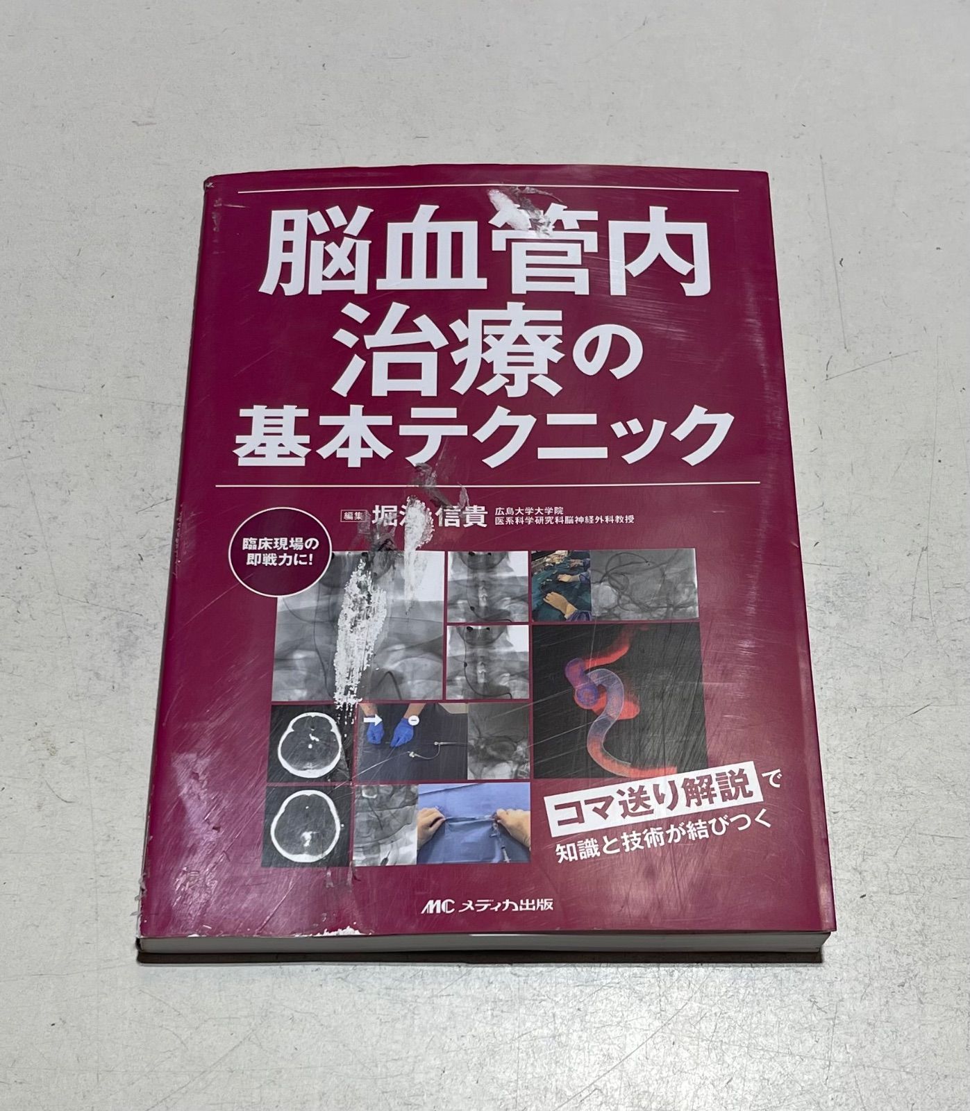 脳血管内治療の基本テクニック - 堀江信貴