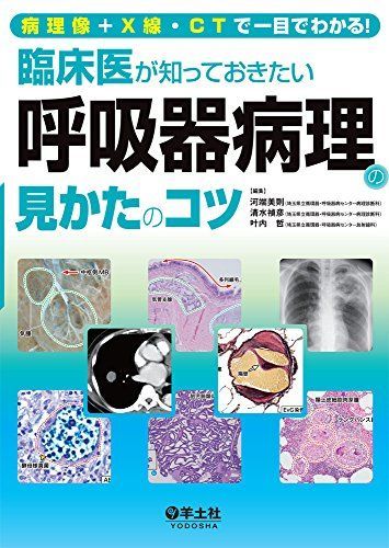 病理像＋X線 CTで一目でわかる 臨床医が知っておきたい呼吸器病理の見かたのコツ