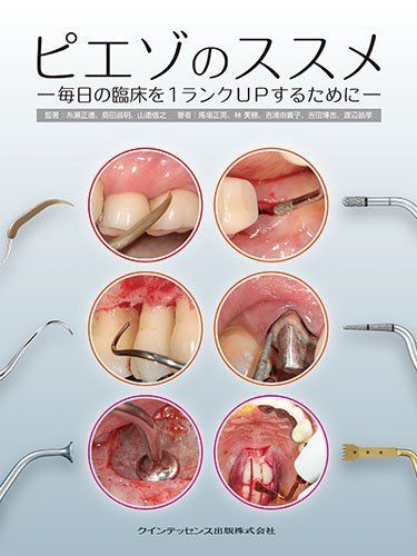 ピエゾのススメ