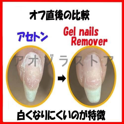 今日の超目玉 新品 未使用 在庫セール 化粧品登録済 アセトンフリー ジェルネイルリムーバー 150ml ネイルアート用品 Elliottsweb Com Elliottsweb Com