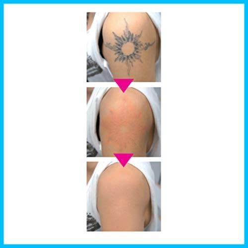 タトゥーコンシーラー 三善