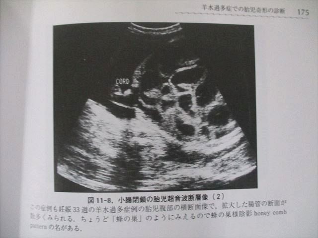 UP81-021 南山堂 周産期の母児管理 改訂5版 島田信宏 55R3D - メルカリ