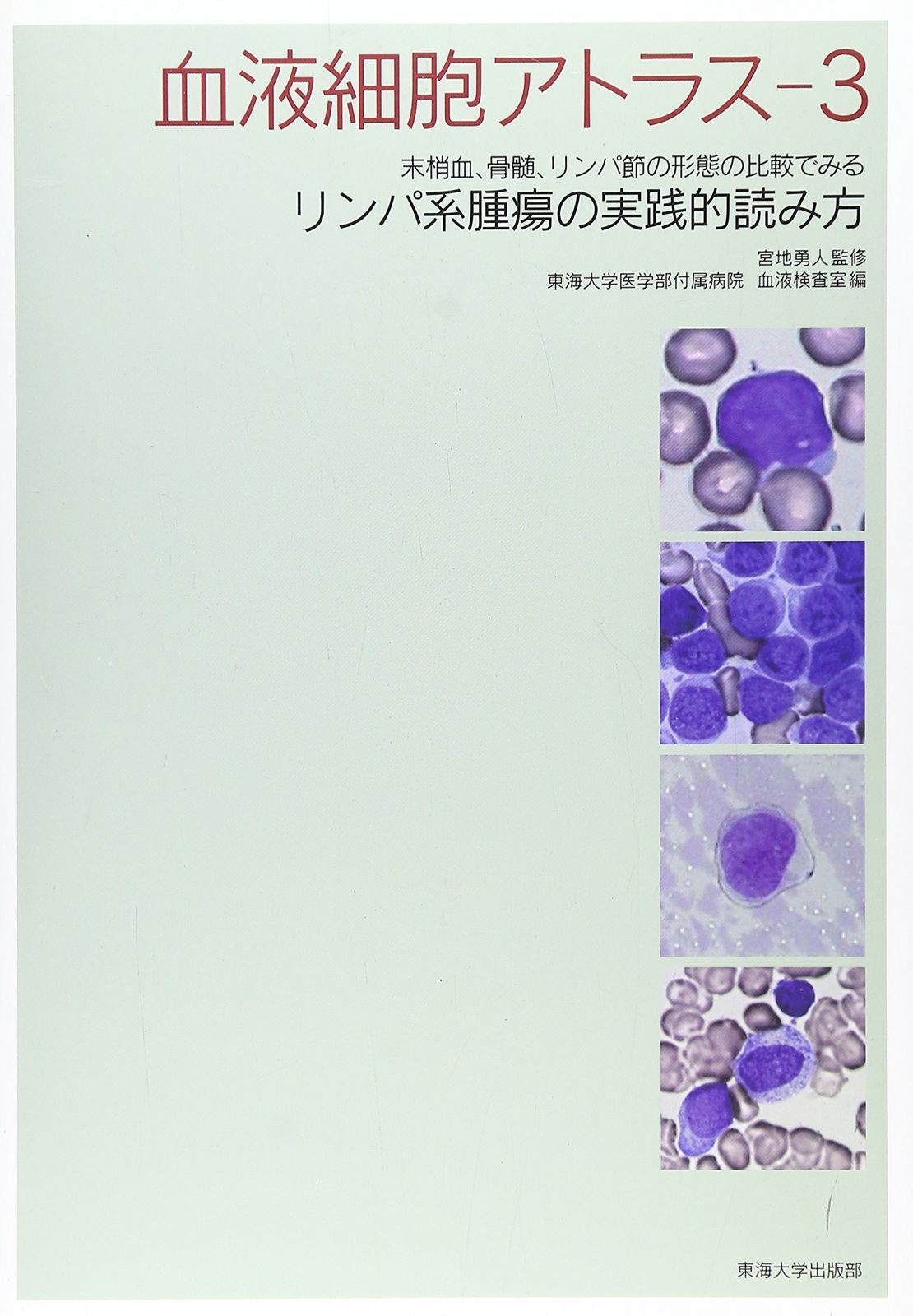 血液細胞アトラス 3: 末梢血、骨髄、リンパ節の形態の比較でみるリンパ