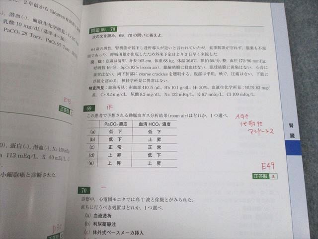 UI12-008 日本内科学会 認定内科医試験 総合内科専門医試験 過去問題集