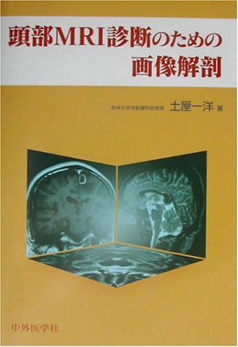 頭部MRI診断のための画像解剖 土屋 一洋 - 参考書・教材専門店