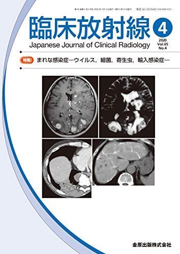 臨床放射線 2020年 04 月号 [雑誌] - メルカリ