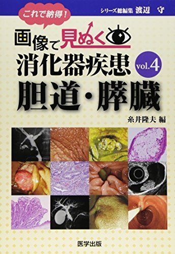 これで納得!画像で見ぬく消化器疾患 (vol.4) - メルカリ これで納得!画像で見ぬく消化器疾患 (vol.4) - メルカリ