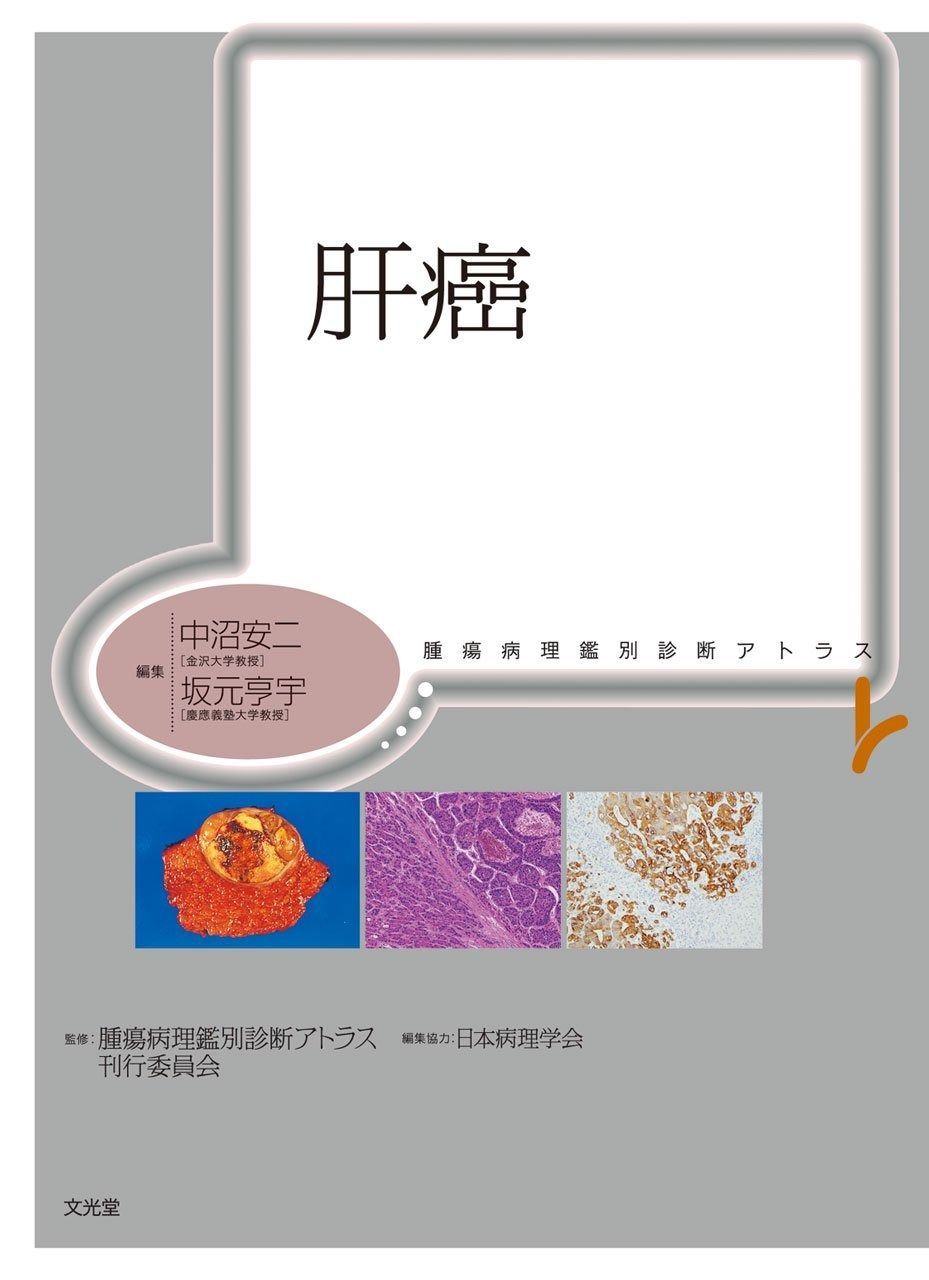 肝癌: 腫瘍病理鑑別診断アトラス 【公式通販】