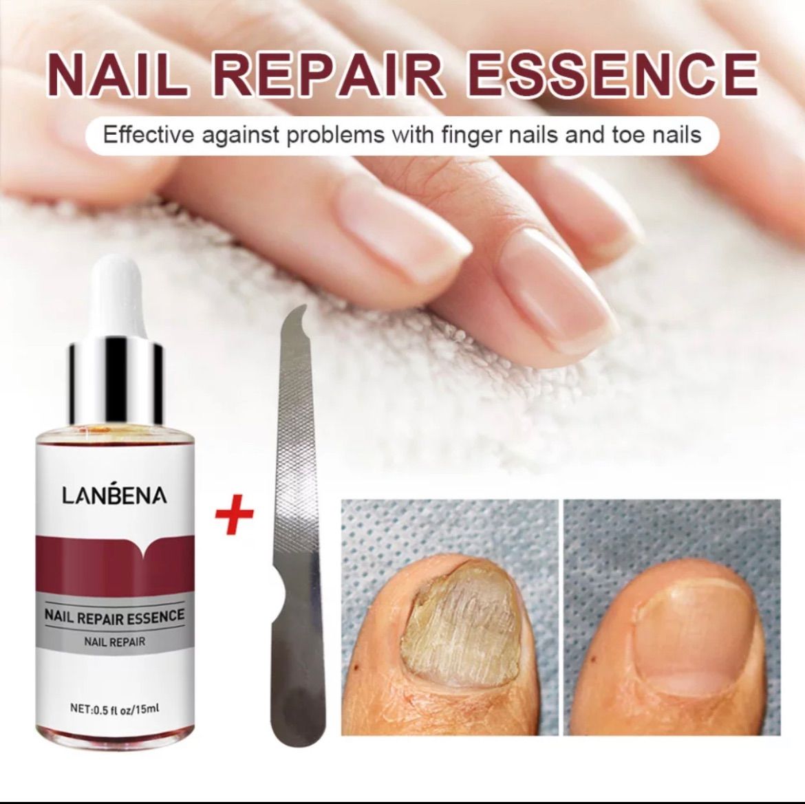 メルカリshops Lanbena ネイルリペアエッセンス 爪修復