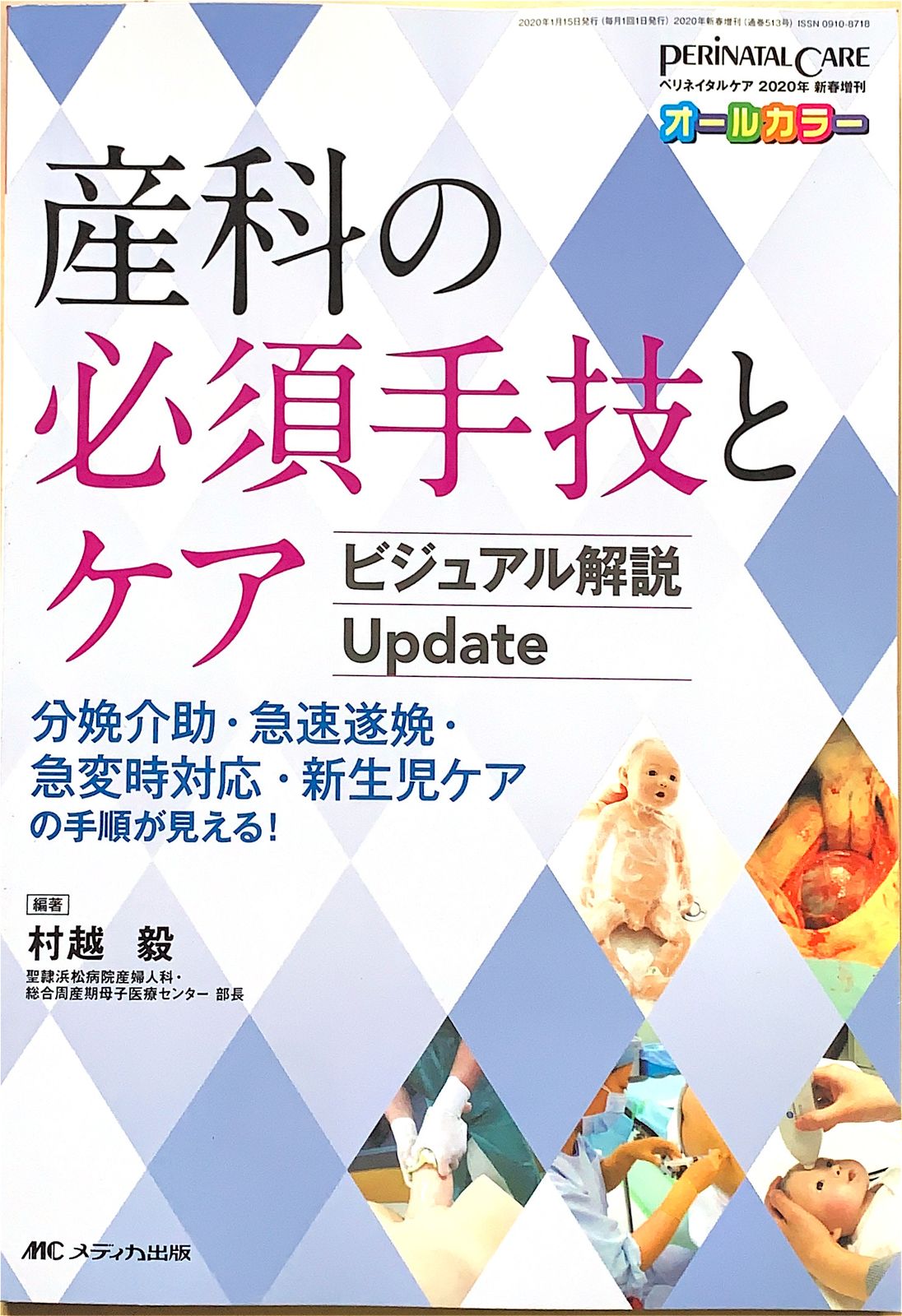 脳神経外科医のための脊椎外科 必須手技と合併症回避のコツ 脳神経外科医のための脊椎外科 必須手技と合併症回避のコツ