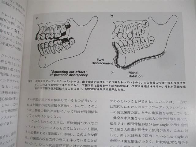 東京臨床出版 顎顔面のダイナミックスを考慮した不正咬合治療へのアプローチ TORIN BOOKS 1991 佐藤貞雄 ☆ 024M6D 東京臨床出版 顎顔面のダイナミックスを考慮した不正咬合治療への