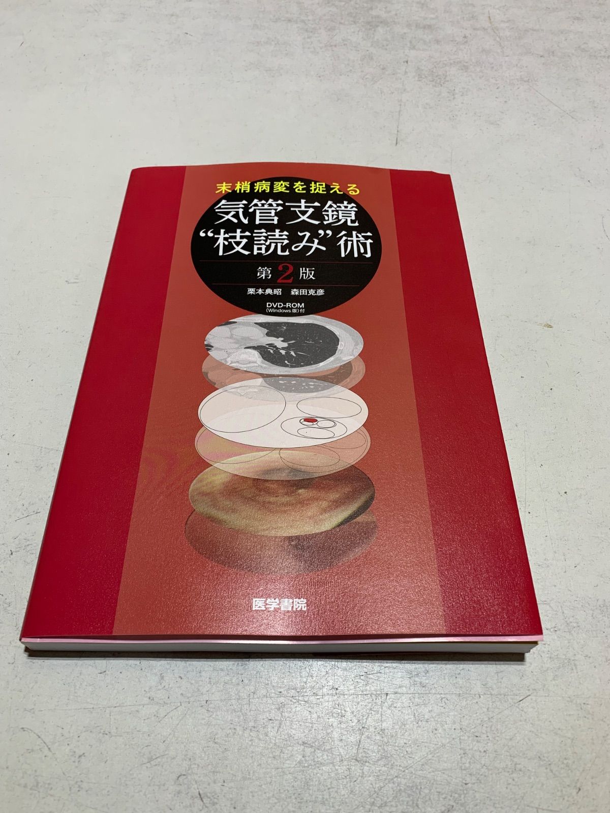 末梢病変を捉える気管支鏡