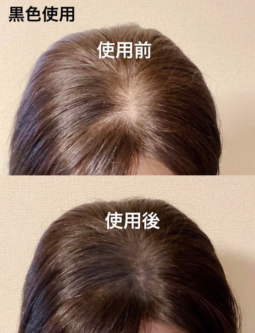 ヘアシャドウ ヘアパウダー 生え際 つむじ ブラック 白髪 薄毛