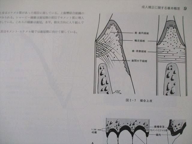 西村書店 成人矯正歯科アトラス 040L6D 西村書店 成人矯正歯科アトラス 040L6D : ブックスドリーム 学参
