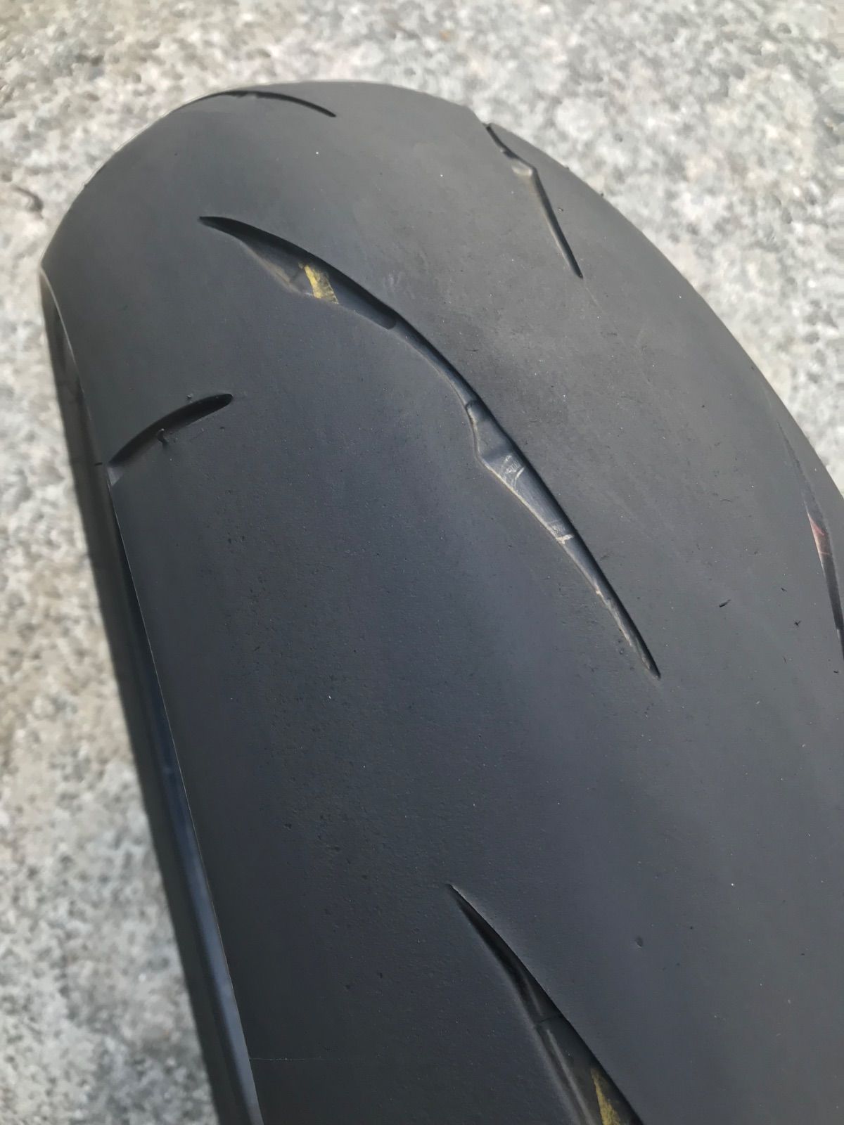 RS11