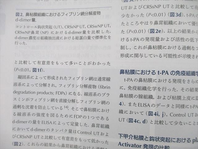 UK25-085 福井大学 学術研究院医学系部門 好酸球性副鼻腔炎の病態解明と新たな治療戦略 状態良 2020 藤枝重治 33M3D