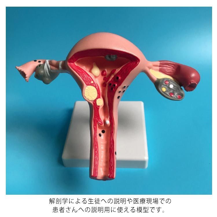 1、医療用 模型 子宮 解剖学的女性生殖器模型 木製ケース入り 送料込みで発送 Amazon.co.jp: 婦人科卵巣解剖学的シミュレーションモデル女性