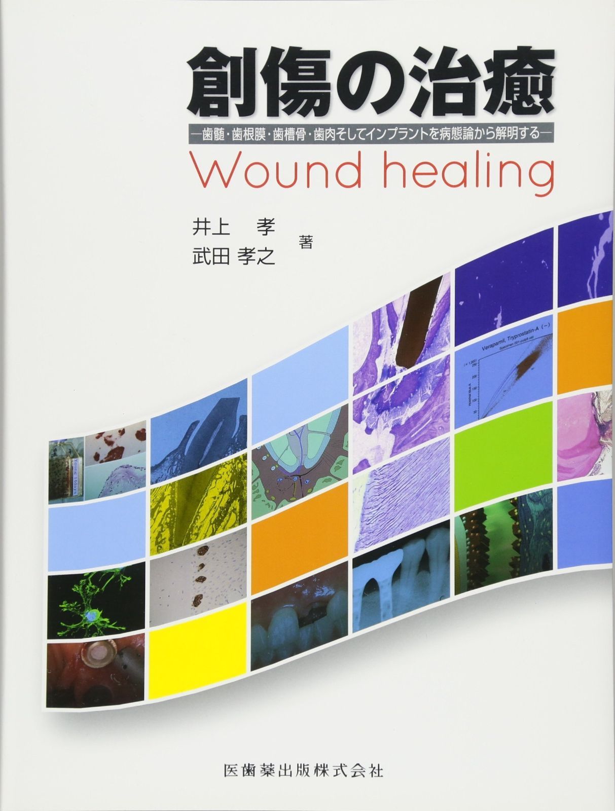 創傷の治癒歯髄 歯根膜 歯槽骨 歯肉そしてインプラントを病態論から解明する