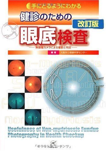 健診のための眼底検査 改訂版?無散瞳カメラによる撮影と判定? (手にとるようにわかる)