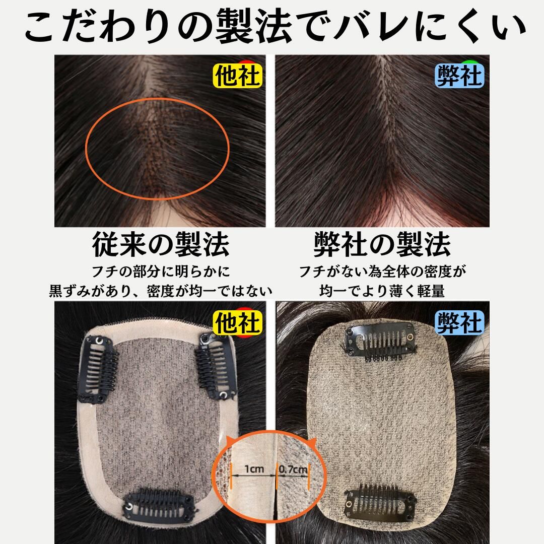 脱毛