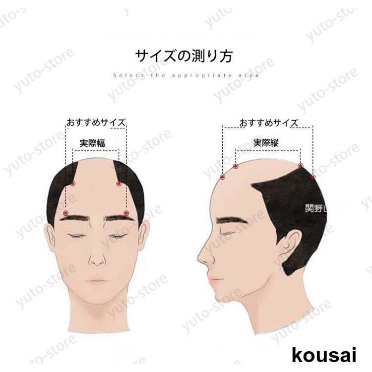 トップウィッグ