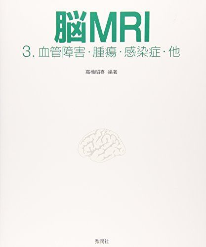 脳MRI 3 血管障害・腫瘍・感染症・他 脳MRI 3.血管障害・腫瘍・感染症・他 高橋昭喜 【公式通販】