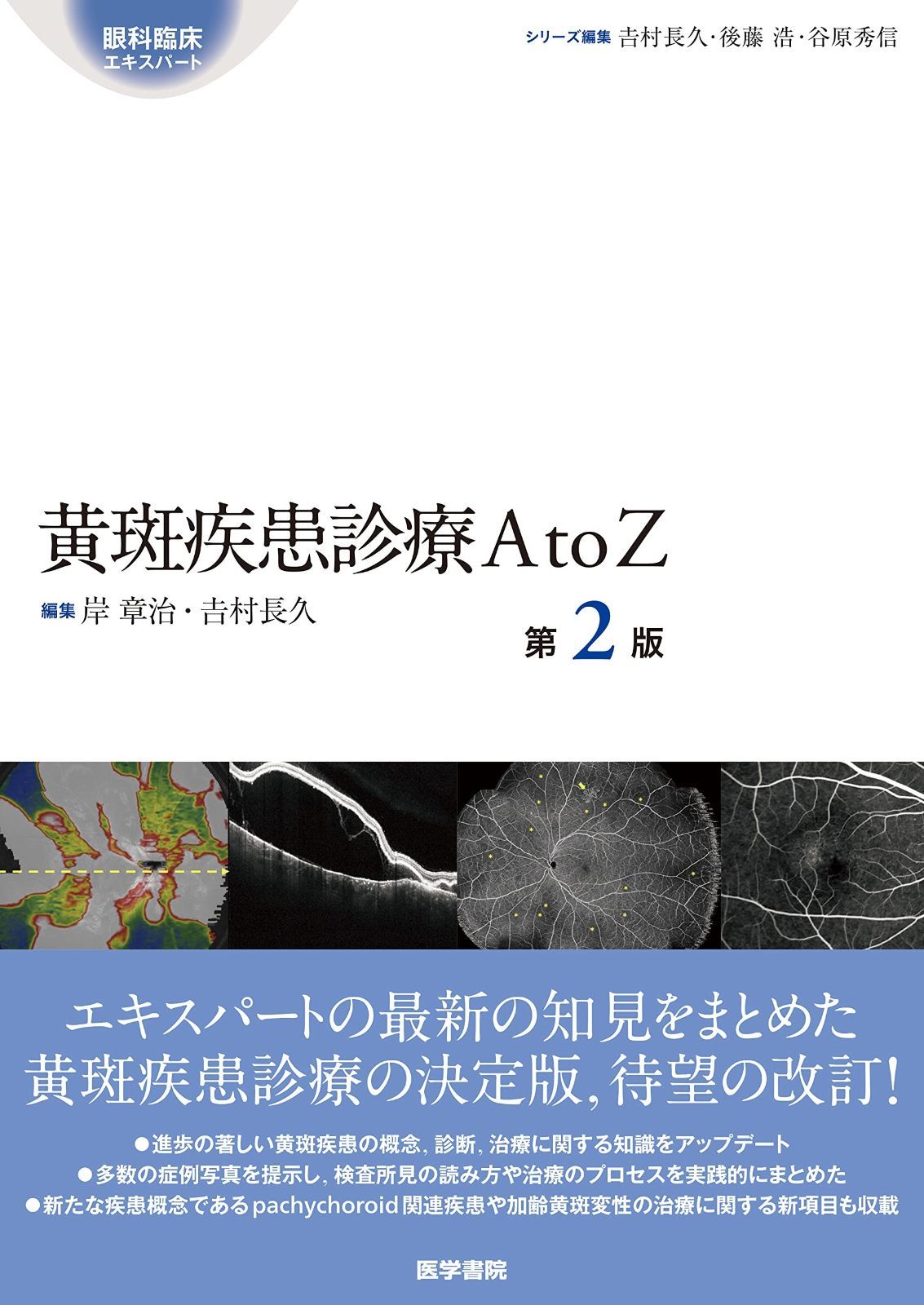 本 黄斑疾患診療AtoZ 第2版 (眼科臨床エキスパート)