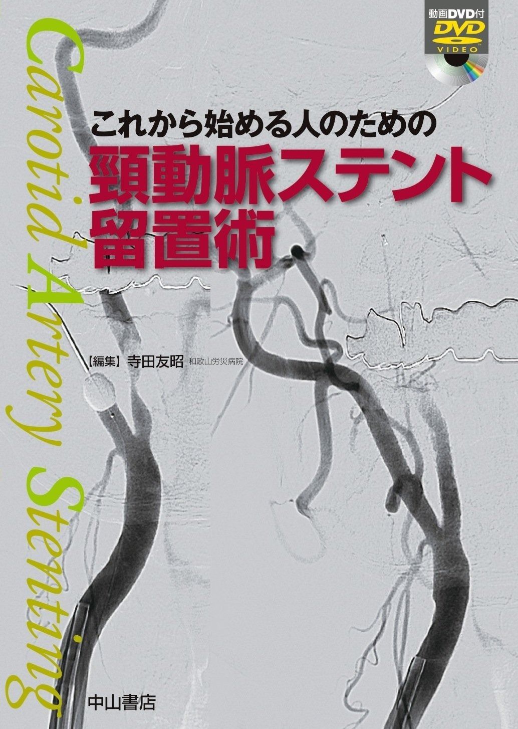 これから始める人のための頸動脈ステント留置術