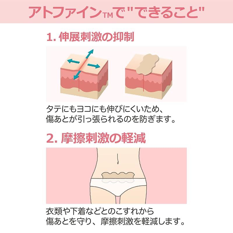 傷あとケア用品 アトファイン