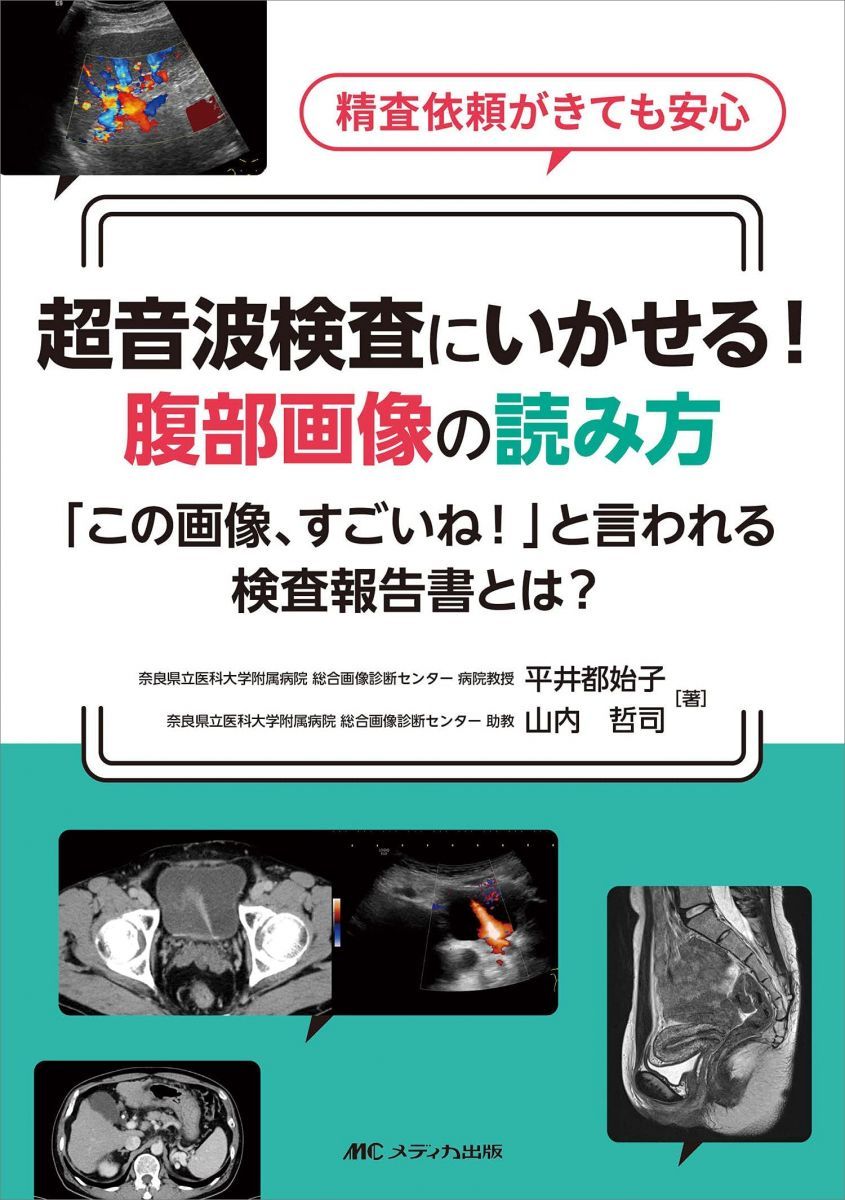 超音波検査にいかせる! 腹部画像の読み方: 「この画像、すごいね! 」と言われる検査報告書とは? [単行本（ソフトカバー）] 平井 都始子; 山内 哲司