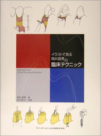 イラストで見る筒井昌秀の臨床テクニック/筒井 昌秀 イラストで見る筒井昌秀の臨床テクニック/筒井 昌秀