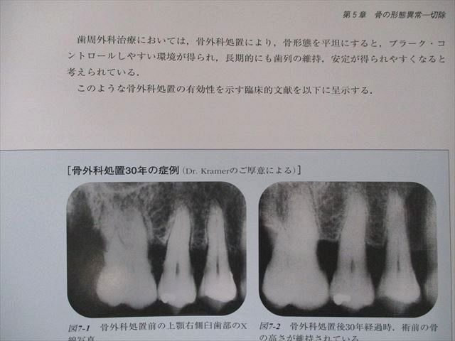 35R3D-　コンセプトをもった予知性の高い歯周外科処置　2001　UP81-002　クインテッセンス出版