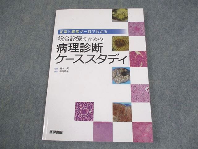 医学書院 正常と異常が一目でわかる総合診療のための病理診断ケーススタディ 2019 010m3D 正常と異常が一目でわかる 総合診療のための病理診断ケース