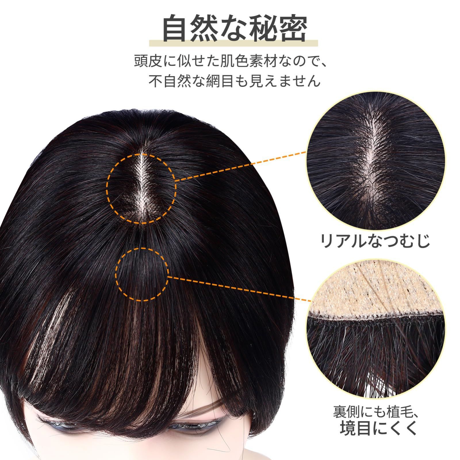 ハゲ隠し 増毛