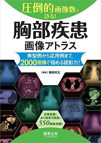 圧倒的画像数で診る! 胸部疾患画像アトラス-典型例から応用例まで、2000画像で極める読影力!